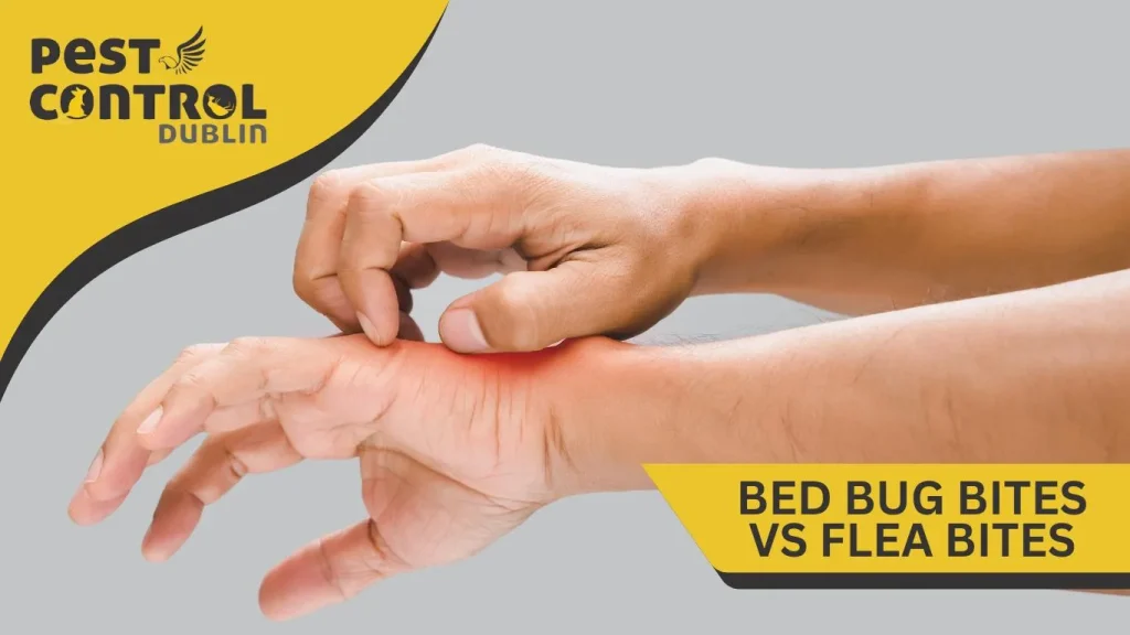 bed bug bites vs flea bites