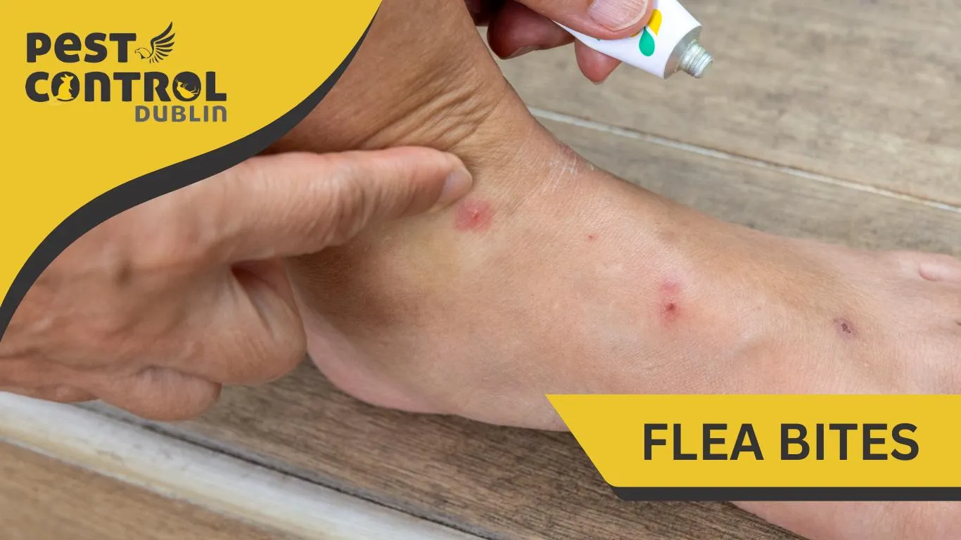 fle bites pest control Dublin
